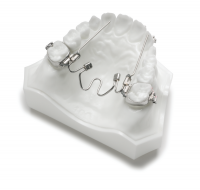 Nitanium Palatal Expander