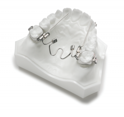 Nitanium Palatal Expander 40mm Qty. 1  ( tijdelijk uitverkocht )